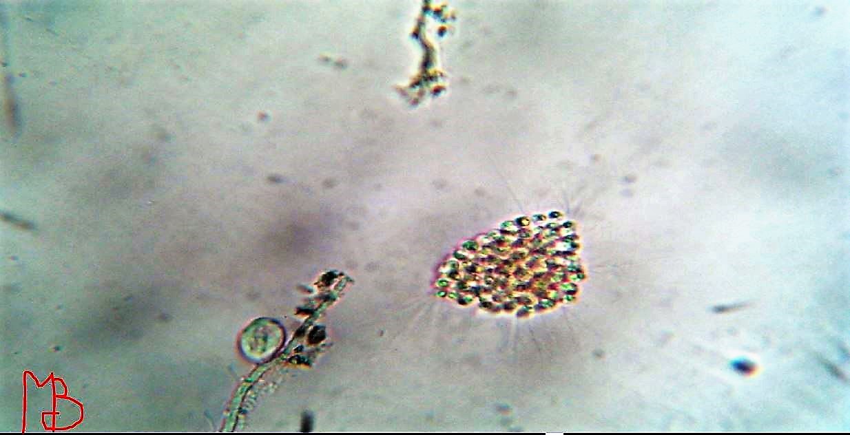 possibile colonia di Crysophycae sp?